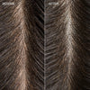 Close-up before and after comparison of the scalp