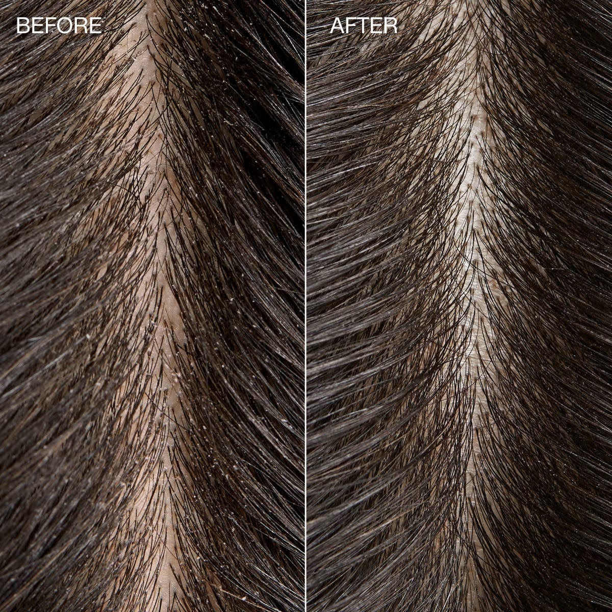 Close-up before and after comparison of the scalp