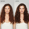 HydraTriplex Treatment