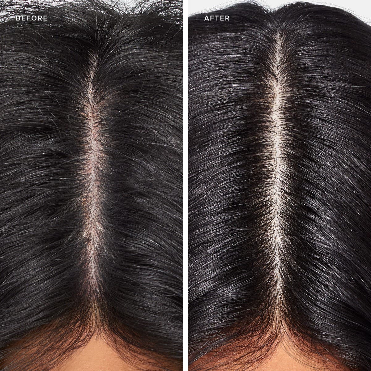 Clean Beauty Scalp